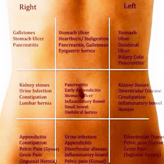 Stomach Pain Chart to Understand What Your Pain Tells You