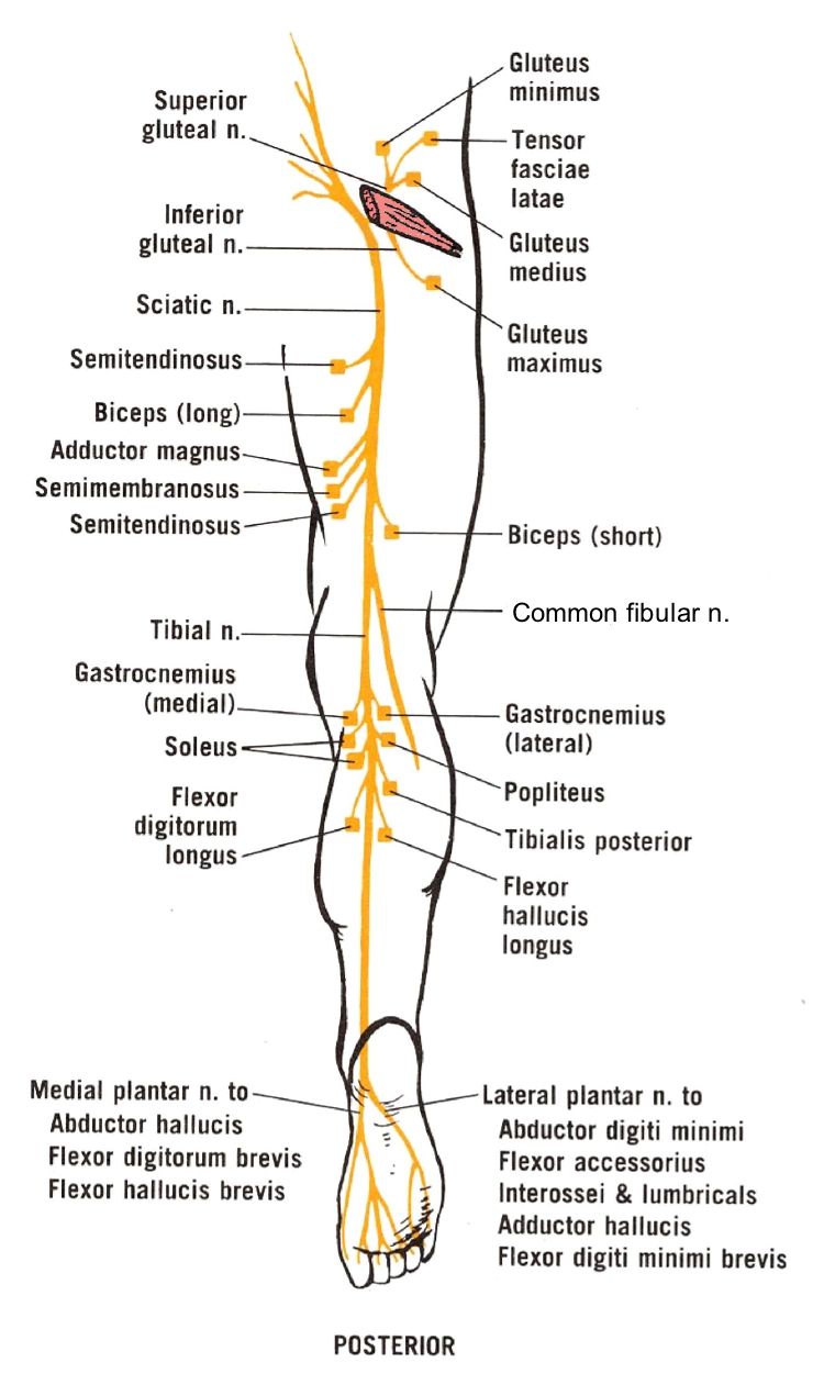 Sciatica Chart