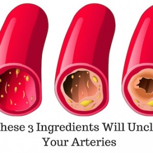 Make Excellent Coronary Arteries Cleanse with Just Three Ingredients