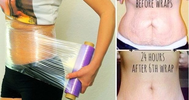 Get Rid of Stubborn Belly Fat with These Magical Ginger Wraps