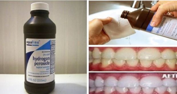 How to Use Hydrogen Peroxide in 24 Incredible Ways