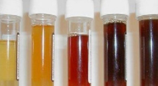 the color of urine reveals the condition of the body healthinasecondcom