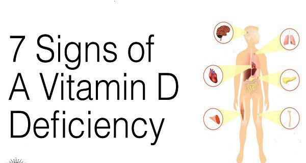 If You Have Experienced Any Of These Signs, You Have Vitamin D Deficiency