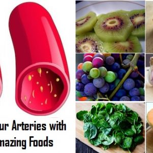 Cleanse Your Arteries with These 10 Amazing Foods