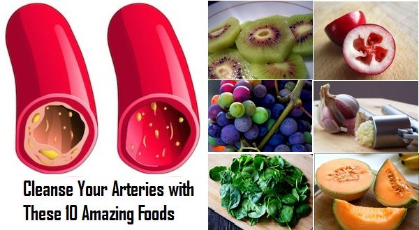 Cleanse Your Arteries with These 10 Amazing Foods