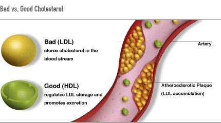 Eliminate Blood Glucose, Lipids, Triglycerides and Cholesterol with This Simple Remedy