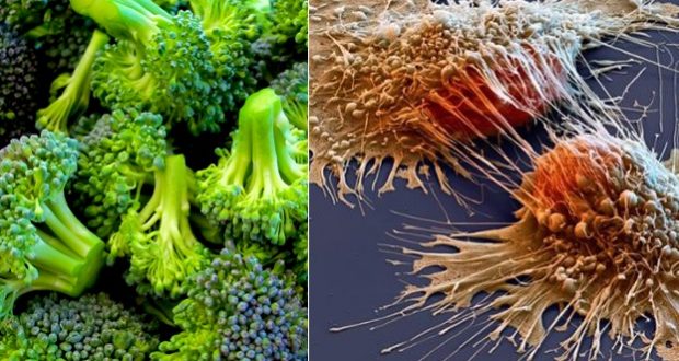 Destroy Cancer with These Eight Amazing Foods