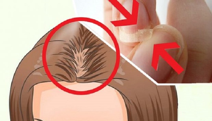 If Your Hair is Falling Off, Your Nails are Broken and You Cannot Get Enough of Sleep, Here is What’s Wrong