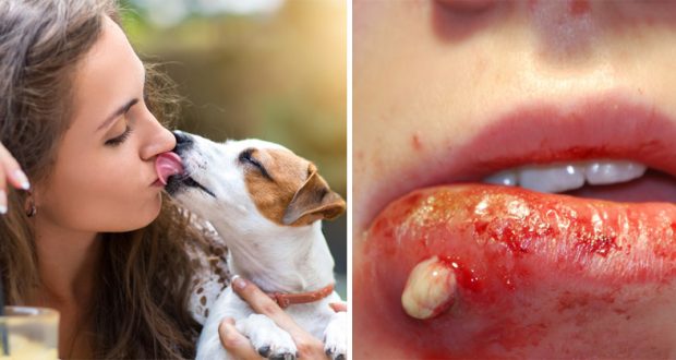 You Should Never Let Your Dog Lick You, And Here’s Why