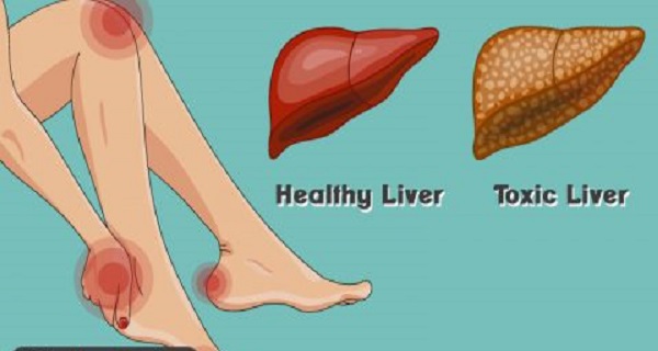 14 Symptoms That Can Be a Warning about Your Liver