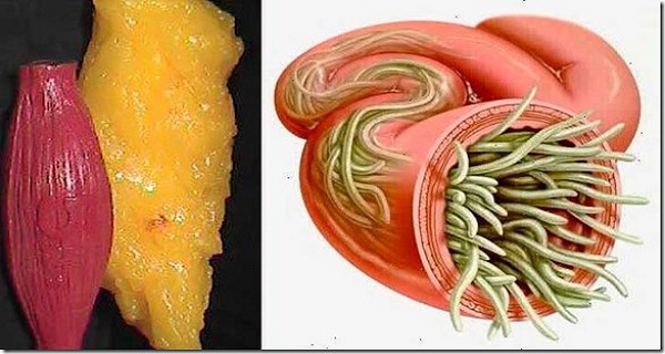 Throw Away All Deposits of Fat and Parasites From Your Body With These Two Ingredients