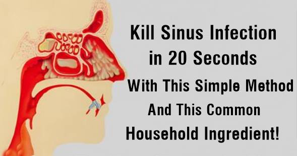 Do You Have Sinus Infection? Get Rid of It In Just 20 Seconds With This Remedy