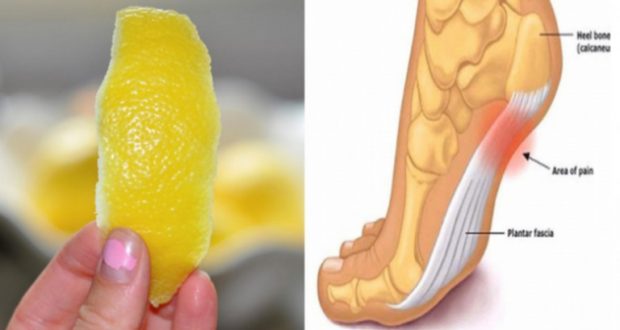 Did You Know That Lemon Peel Can Help You with Joint Pain?