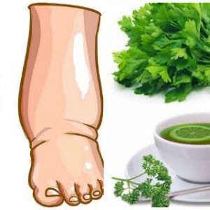 Cure Your Swollen Legs in Just A few Days with This Easy Remedy