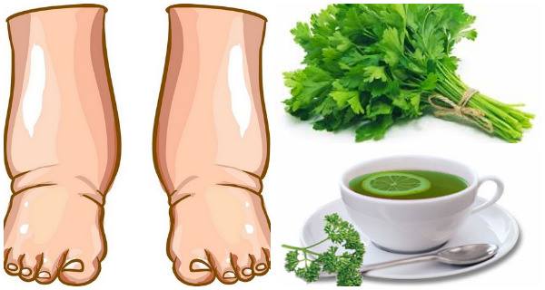 swelling in legs home remedies