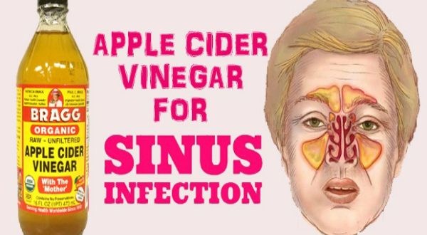 Get Rid of a Sinus Infection Using Apple Cider Vinegar in These Ways