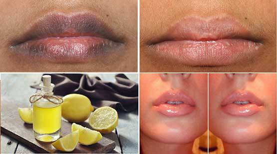 Make Your Lips Pretty and Soft Again with Just Two Ingredients