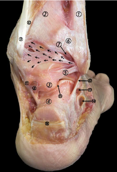 Anatomic Dissection Of The Sprained Ankle ...