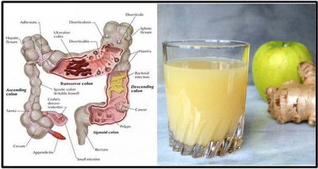 The Healthiest Cleansing and Antioxidant Tonic for The Colon!