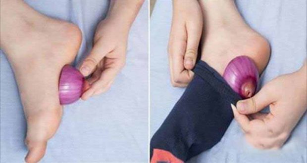 Put Onions in Your Socks Before Going to Bed and See What Happens