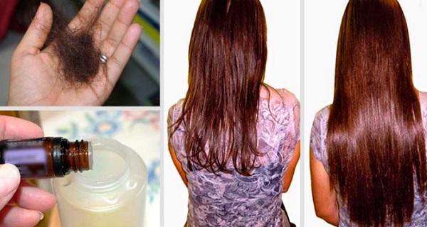 Having Trouble with Hair Loss? Add These Two Ingredients to Your Shampoo and Problem is Solved