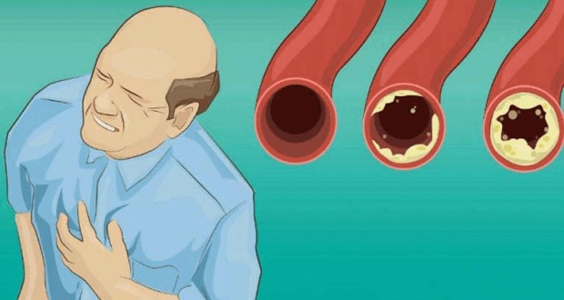 18 Foods To Cleans Your Arteries & Protect You From Heart Attacks