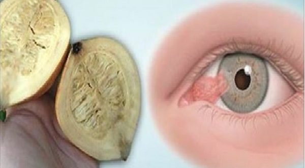 Get Rid of Your Glasses Once and for All with This Amazing Remedy