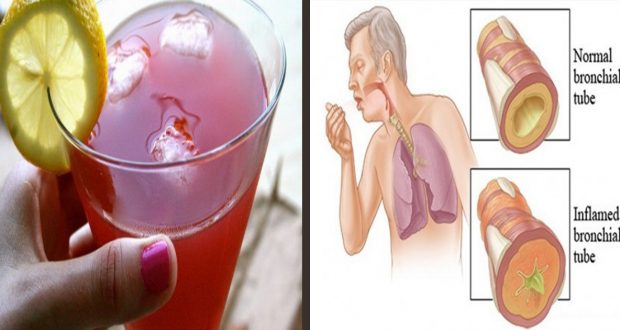 Easy and Healthy: Eliminate Sinus Problems and Mucus Congestion with This Remedy