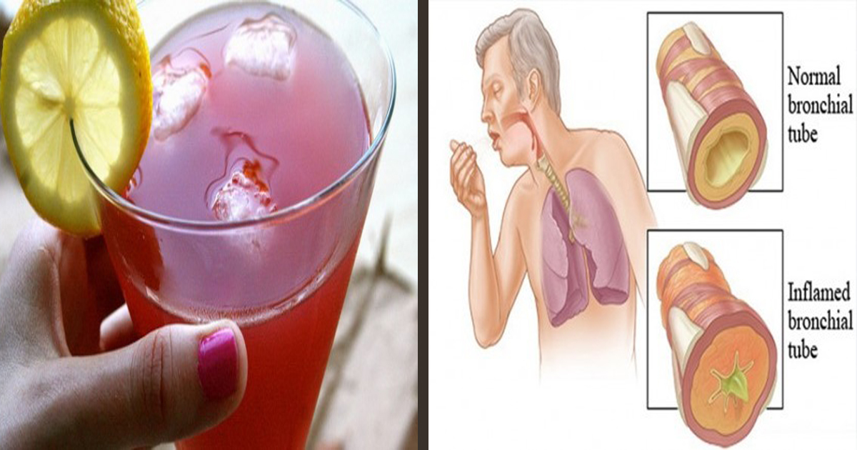 easy-and-healthy-eliminate-sinus-problems-and-mucus-congestion-with