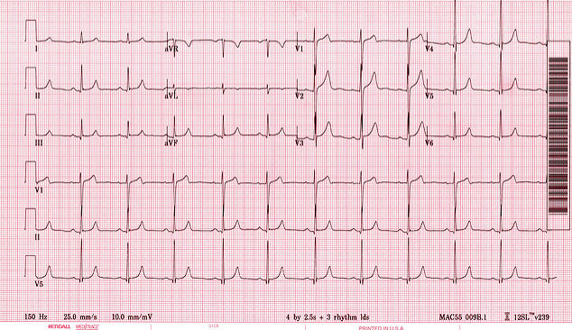 Make Sure You Know THIS About Heart Attacks!