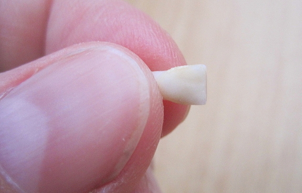 Little Thing That Can Save Child’s Life: Don’t Throw Away a Baby Tooth