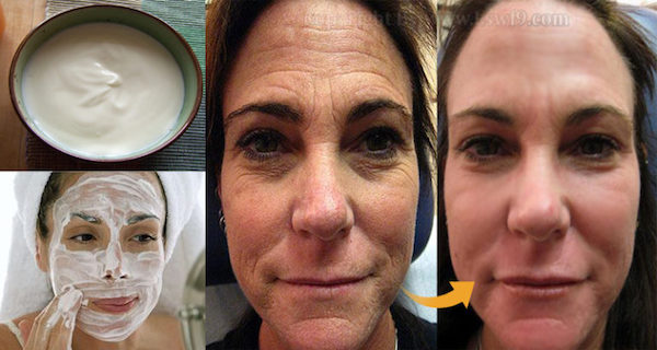 This Turkish Recipe Will Help You Reduce All Wrinkles on Your Skin(Video)