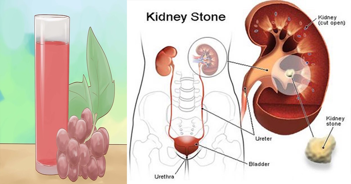 Cleanse Your Kidneys with This Simple Recipe