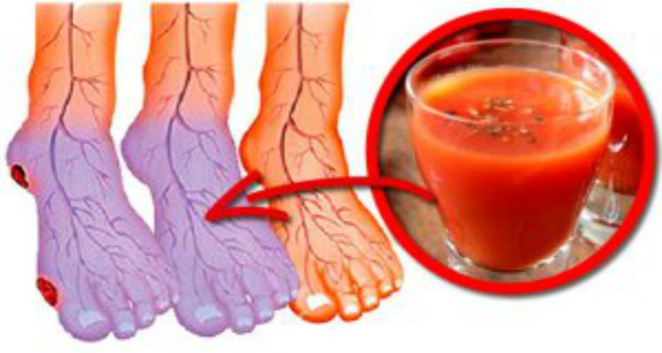 Cold Hands and Feet? 5 Natural Ways to Improve Poor Blood Circulation