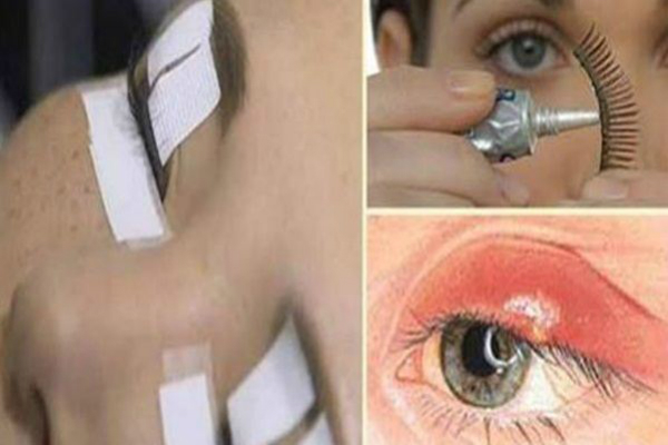 The Hidden Dangers of Eyelash Extensions