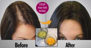 Amazing Keratin Mask Will Clean your Scalp And Boost Your Hair Growth