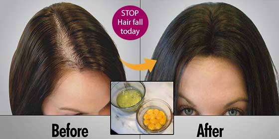 Amazing Keratin Mask Will Clean your Scalp And Boost Your Hair Growth